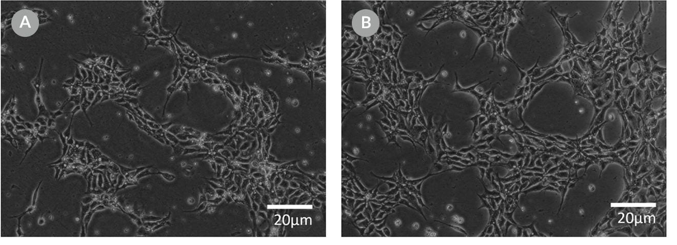 Cell morphology images of ES cells plated in  mTeSR™1 and mTeSR™ Plus and supplemented with CloneR™ immediately following RNP electroporation.