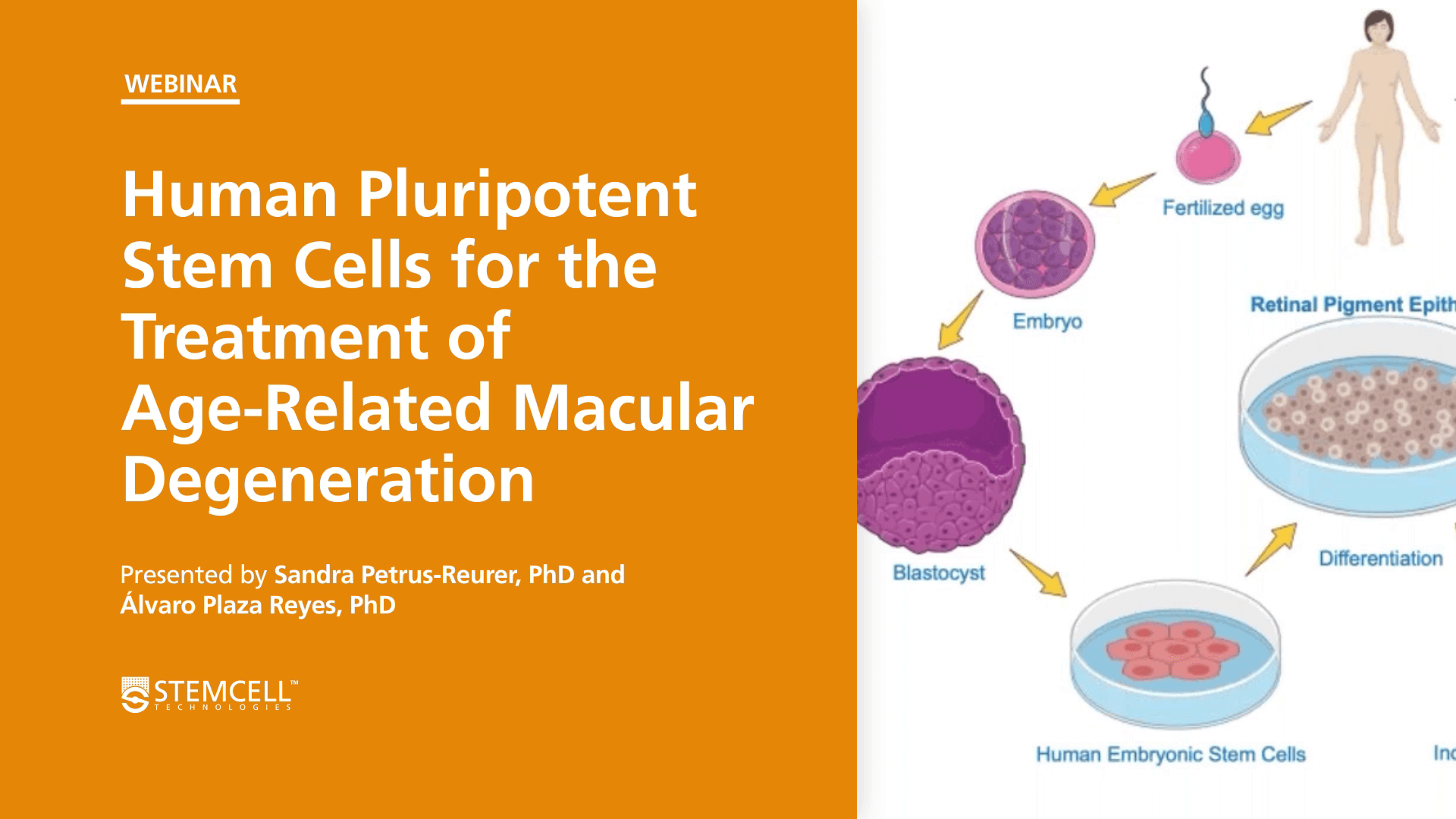 Human Pluripotent Stem Cells for the Treatment of Age-Related Macular Degeneration and Compliance Considerations for Clinical-Grade iPSCs