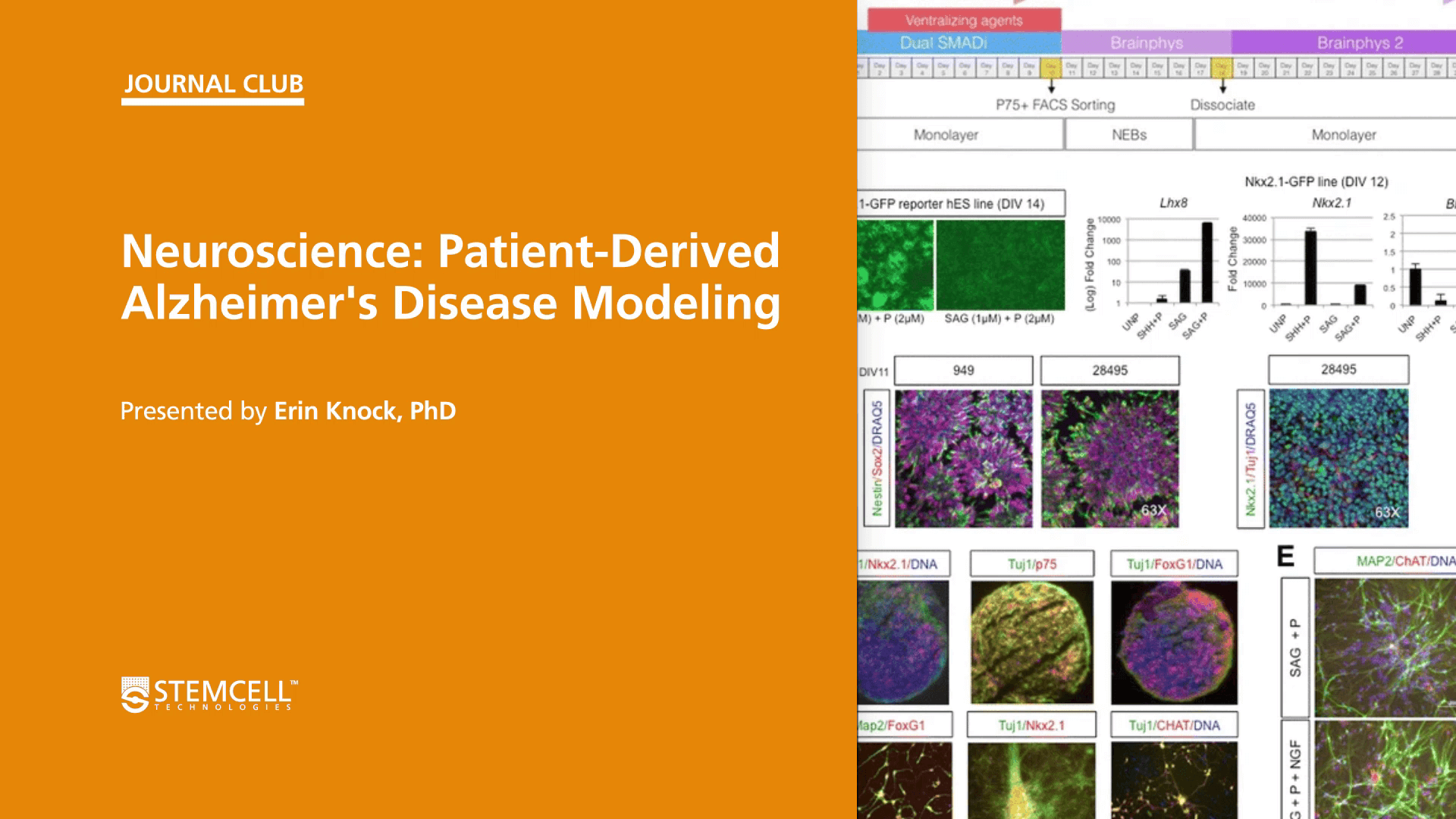 STEMCELL Journal Club: Patient-Derived Alzheimer’s Disease Modeling